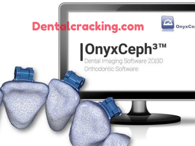 Onyxceph 3.2.211 crack